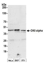 CKII alpha Antibody in Western Blot (WB)