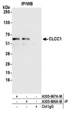 CLCC1 Antibody in Immunoprecipitation (IP)