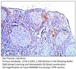 Calcitonin Antibody in Immunohistochemistry (IHC)