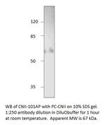 NT5C2 Antibody in Western Blot (WB)