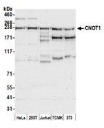 CNOT1 Antibody in Western Blot (WB)