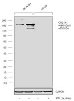 COL1A1 Antibody in Western Blot (WB)