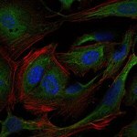 Crk Antibody in Immunocytochemistry (ICC/IF)