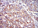 Crk Antibody in Immunohistochemistry (Paraffin) (IHC (P))