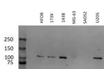 CRM1 Antibody in Western Blot (WB)