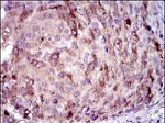 CRP Antibody in Immunohistochemistry (Paraffin) (IHC (P))