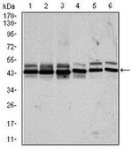 CK2 alpha-2 Antibody in Western Blot (WB)