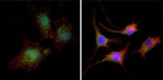 beta Catenin Antibody in Immunocytochemistry (ICC/IF)