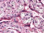 beta Catenin Antibody in Immunohistochemistry (Paraffin) (IHC (P))