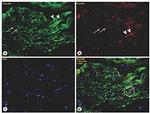 PGP9.5 Antibody in Immunohistochemistry (IHC)