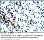 Cyclin D1 Antibody in Immunohistochemistry (IHC)