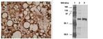 CYP4F11 Antibody in Immunohistochemistry (Paraffin) (IHC (P))