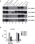 CaMKII beta Antibody in Western Blot (WB)