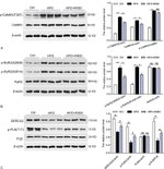 Phospho-CaMKII beta/gamma/delta (Thr287) Antibody in Western Blot (WB)