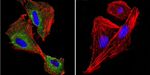 P-cadherin Antibody in Immunocytochemistry (ICC/IF)