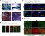 CaV1.1 Antibody in Immunohistochemistry (IHC)