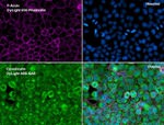 Calreticulin Antibody in Immunocytochemistry (ICC/IF)