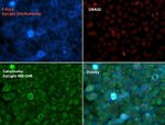 Calreticulin Antibody in Immunocytochemistry (ICC/IF)