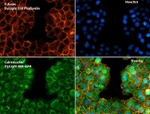 Calreticulin Antibody in Immunocytochemistry (ICC/IF)