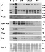 Phospholamban Antibody in Western Blot (WB)