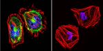 beta Catenin Antibody in Immunocytochemistry (ICC/IF)