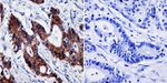 beta Catenin Antibody in Immunohistochemistry (Paraffin) (IHC (P))