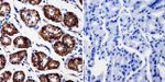 beta Catenin Antibody in Immunohistochemistry (Paraffin) (IHC (P))