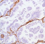 Caveolin 1 Antibody in Immunohistochemistry (Paraffin) (IHC (P))