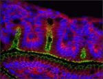 Claudin 1 Antibody in Immunohistochemistry (Frozen) (IHC (F))