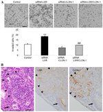 Claudin 1 Antibody in Immunohistochemistry (IHC)