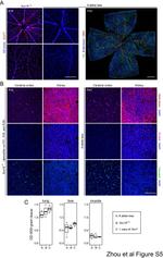 Claudin 5 Antibody in Immunohistochemistry (IHC)