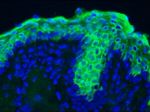 Cytokeratin 10 Antibody in Immunohistochemistry (Frozen) (IHC (F))