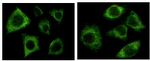 Cytokeratin 5 Antibody in Immunocytochemistry (ICC/IF)