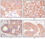 Cytokeratin 5 Antibody in Immunohistochemistry (Paraffin) (IHC (P))