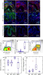 Pan Cytokeratin Antibody in Immunohistochemistry (IHC)