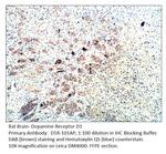 Dopamine Receptor D1 Antibody in Immunohistochemistry (IHC)