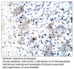 Dopamine D2 Receptor Antibody in Immunohistochemistry (IHC)