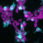 Mouse IgG (H+L) Highly Cross-Adsorbed Secondary Antibody in Immunocytochemistry (ICC/IF)