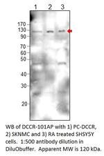 DCC Antibody in Western Blot (WB)