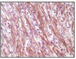 Desmin Antibody in Immunohistochemistry (Paraffin) (IHC (P))