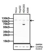 DNMT3A Antibody in Western Blot (WB)