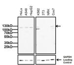 DNMT3A Antibody in Western Blot (WB)