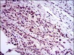 E2F1 Antibody in Immunohistochemistry (Paraffin) (IHC (P))