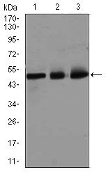 E2F1 Antibody in Western Blot (WB)