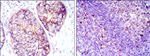 EEF2 Antibody in Immunohistochemistry (Paraffin) (IHC (P))