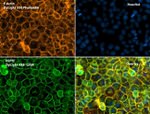 EGFR Antibody in Immunocytochemistry (ICC/IF)