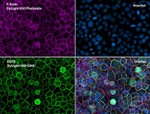 EGFR Antibody in Immunocytochemistry (ICC/IF)