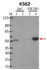 eIF2b gamma Antibody in Immunoprecipitation (IP)