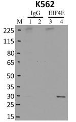 eIF4E Antibody in Immunoprecipitation (IP)