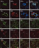 Connexin 43 Antibody in Immunohistochemistry (IHC)